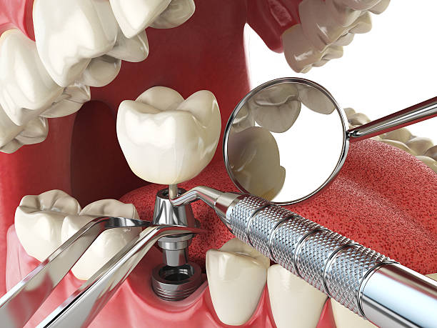 Best Emergency Treatment for Toothache in Goodland, IN